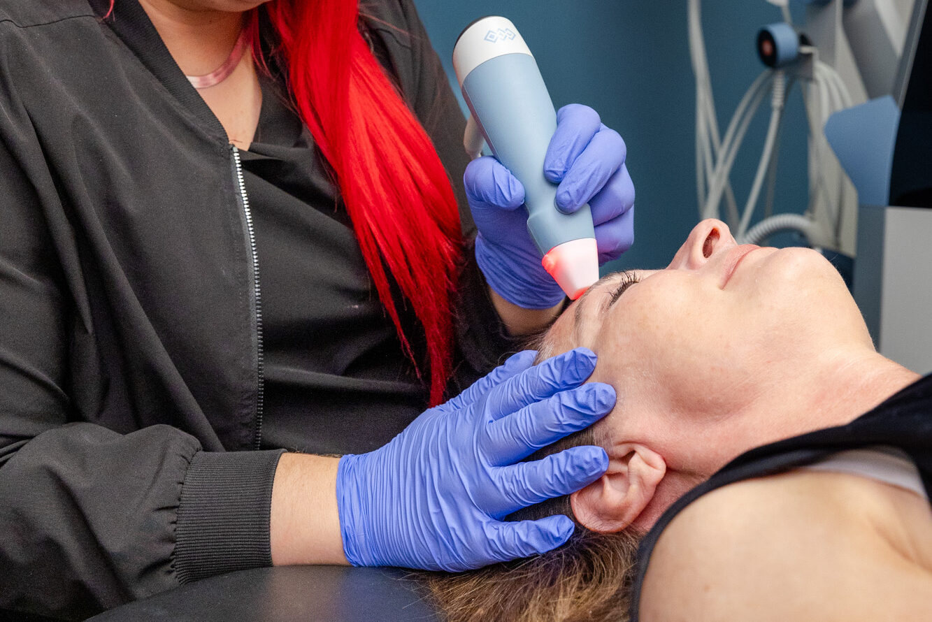 A provider uses the Exion face handpiece to administer skin tightening in Newburgh.